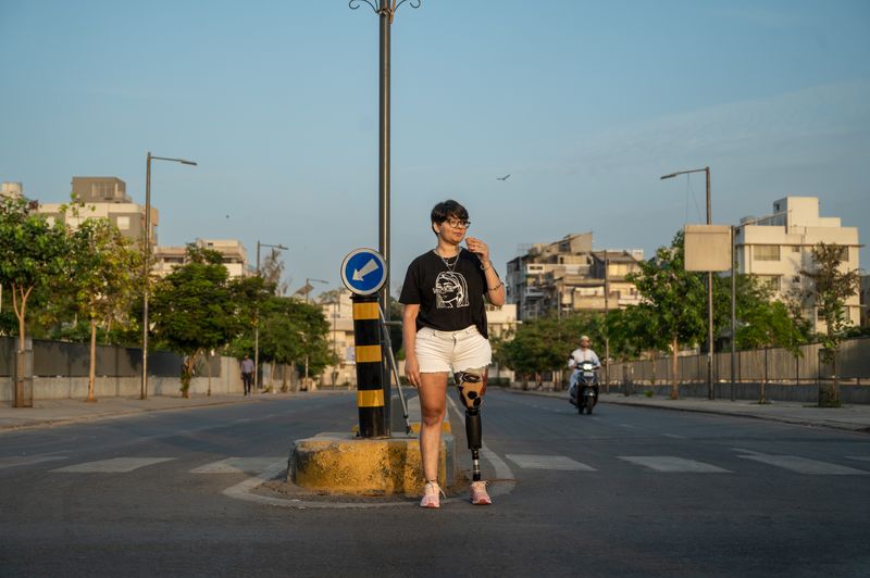 Person with a prosthetic leg crossing a street in Ahmedabad, India